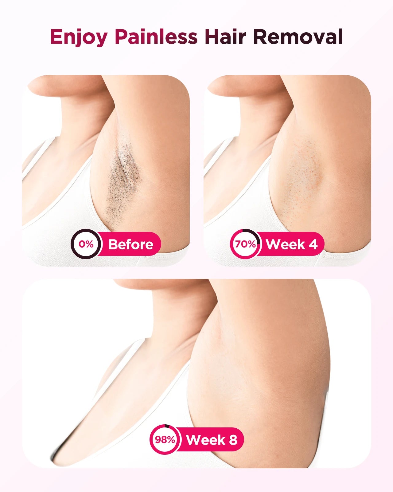 Totmizby IPL Hair Removal Laser Device For Body Facial Bikini